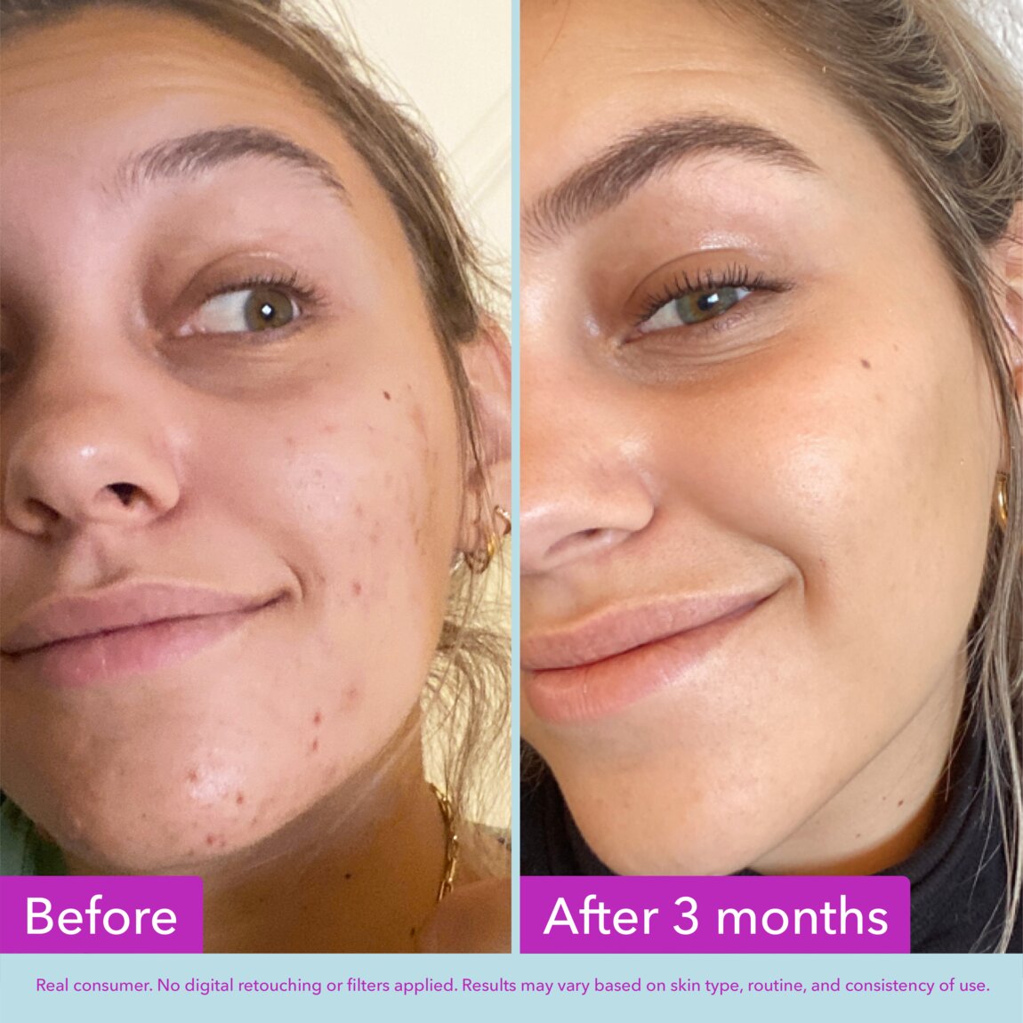 niacinamide-brightening-toner-l7 zb_p.jpg
